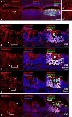 Mapping of Notch signaling in the developing organ of Corti in common marmosets